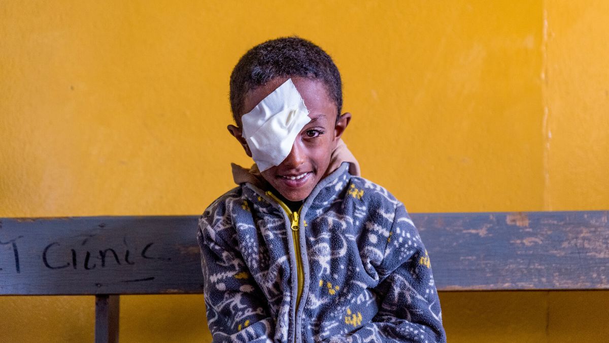 A boy with an eye patch after surgery