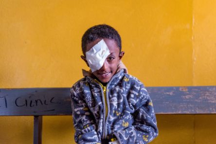 A boy with an eye patch after surgery